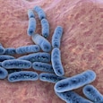 The researchers are focusing on making this bacteria function as a probiotic sensor in the gut to diligently inspect, detect and report any intestinal ailments. (Photo courtesy: Getty)